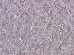 VEGF Antibody in Immunohistochemistry (Paraffin) (IHC (P))