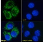 ADORA2A Chimeric Antibody in Immunocytochemistry (ICC/IF)