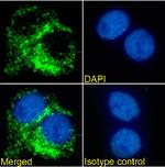 CD63 Chimeric Antibody in Immunocytochemistry (ICC/IF)