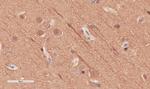 alpha Tubulin Chimeric Antibody in Immunohistochemistry (Paraffin) (IHC (P))