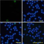 CD105 (Endoglin) Chimeric Antibody in Immunocytochemistry (ICC/IF)