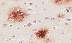 beta Amyloid Chimeric Antibody in Immunohistochemistry (Paraffin) (IHC (P))