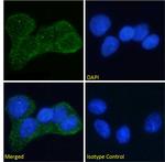 INSR alpha Chimeric Antibody in Immunocytochemistry (ICC/IF)