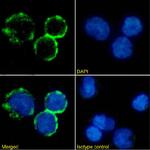 CD154 (CD40 Ligand) Chimeric Antibody in Immunocytochemistry (ICC/IF)