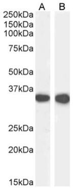 CD74 Chimeric Antibody in Western Blot (WB)