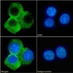 CD70 Chimeric Antibody in Immunocytochemistry (ICC/IF)