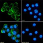 CD153 Chimeric Antibody in Immunocytochemistry (ICC/IF)