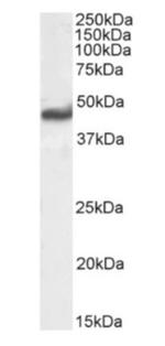 RAGE Chimeric Antibody in Western Blot (WB)