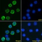 IL-6 Receptor (CD126) Chimeric Antibody in Immunocytochemistry (ICC/IF)