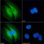 RAP Chimeric Antibody in Immunocytochemistry (ICC/IF)