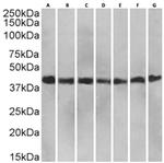 RAP Chimeric Antibody in Western Blot (WB)