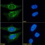 CD171 (L1CAM) Antibody in Immunocytochemistry (ICC/IF)