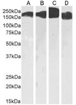 CD171 (L1CAM) Antibody in Western Blot (WB)