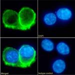 IL10RA Chimeric Antibody in Immunocytochemistry (ICC/IF)