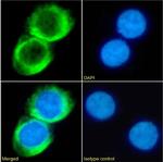 CD23 Chimeric Antibody in Immunocytochemistry (ICC/IF)