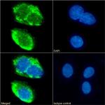 CD36 Chimeric Antibody in Immunocytochemistry (ICC/IF)