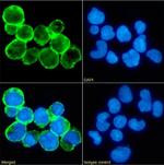 CD59 Chimeric Antibody in Immunocytochemistry (ICC/IF)