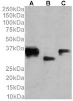 CD74 Chimeric Antibody in Western Blot (WB)