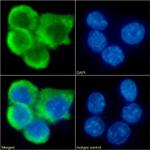 CCR7 Chimeric Antibody in Immunocytochemistry (ICC/IF)