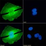 PRMT5 Chimeric Antibody in Immunocytochemistry (ICC/IF)