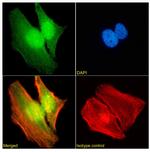 WDR5 Chimeric Antibody in Immunocytochemistry (ICC/IF)