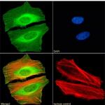 CBX2 Chimeric Antibody in Immunocytochemistry (ICC/IF)