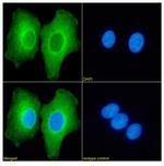 L3MBTL1 Chimeric Antibody in Immunocytochemistry (ICC/IF)