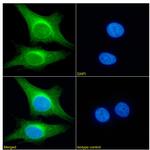 PRDM4 Chimeric Antibody in Immunocytochemistry (ICC/IF)