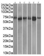 TDRD3 Chimeric Antibody in Western Blot (WB)