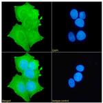 FOXP1 Chimeric Antibody in Immunocytochemistry (ICC/IF)