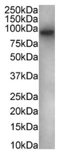 FOXP1 Chimeric Antibody in Western Blot (WB)