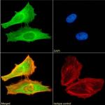 FOXP2 Chimeric Antibody in Immunocytochemistry (ICC/IF)