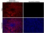 PMEL Antibody in Immunohistochemistry (Paraffin) (IHC (P))