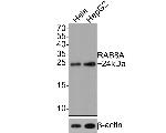 RAB8A Antibody in Western Blot (WB)