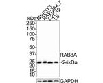 RAB8A Antibody in Western Blot (WB)