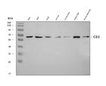 CBS Antibody in Western Blot (WB)