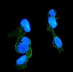 CCR2 Antibody in Immunocytochemistry (ICC/IF)