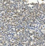 CCR2 Antibody in Immunohistochemistry (Paraffin) (IHC (P))