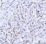 CDK2 Antibody in Immunohistochemistry (Paraffin) (IHC (P))