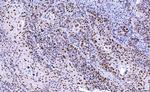 CDK2 Antibody in Immunohistochemistry (Paraffin) (IHC (P))