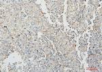 COMT Antibody in Immunohistochemistry (Paraffin) (IHC (P))