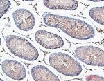 COMT Antibody in Immunohistochemistry (Paraffin) (IHC (P))