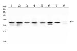 COMT Antibody in Western Blot (WB)