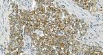 IDH2 Antibody in Immunohistochemistry (Paraffin) (IHC (P))