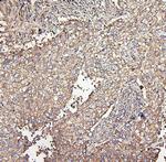 MVP Antibody in Immunohistochemistry (Paraffin) (IHC (P))