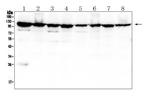 MVP Antibody in Western Blot (WB)