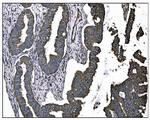 TGFBR2 Antibody in Immunohistochemistry (Paraffin) (IHC (P))