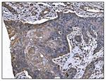 TGFBR2 Antibody in Immunohistochemistry (Paraffin) (IHC (P))