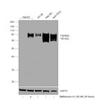 TGFBR2 Antibody