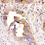 DHFR Antibody in Immunohistochemistry (Paraffin) (IHC (P))